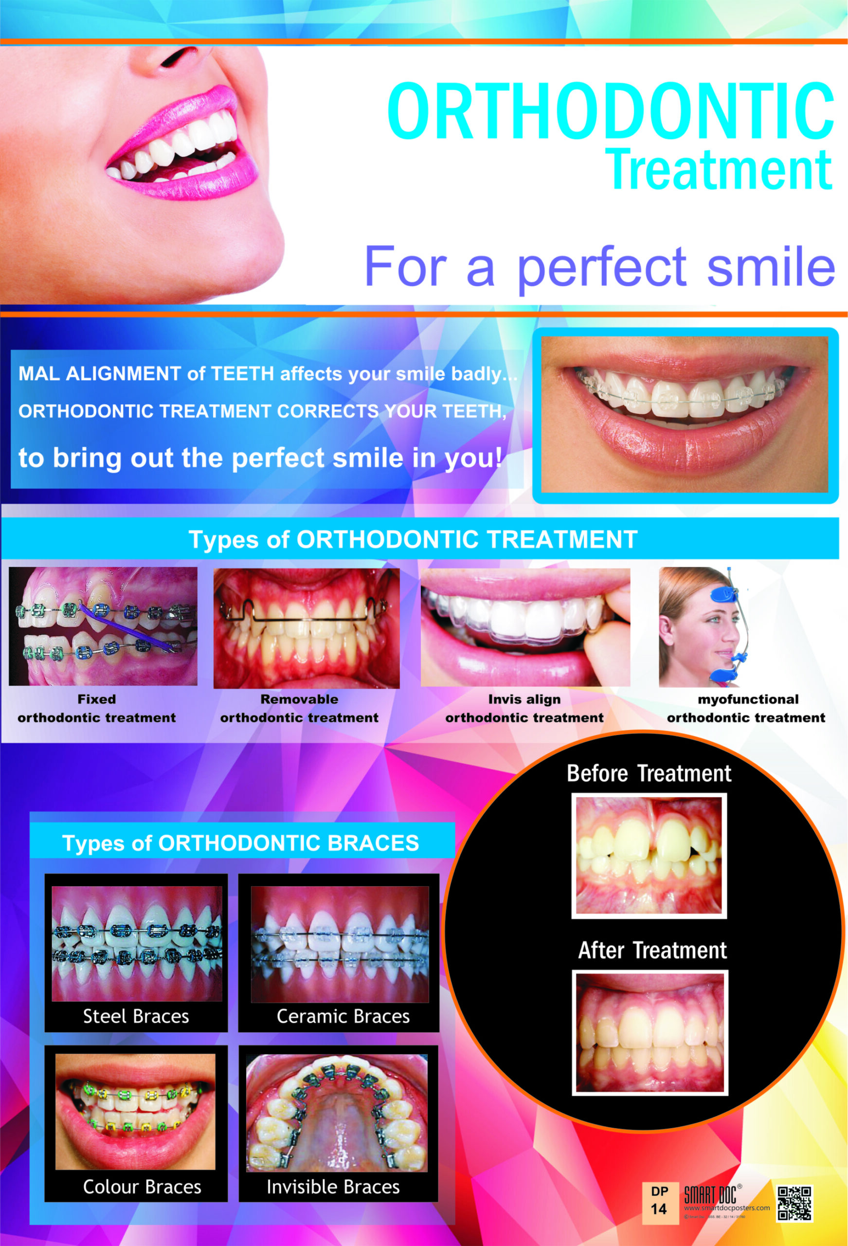 Types Of Orthodontic Treatment Different Types Of Braces Eng Dp