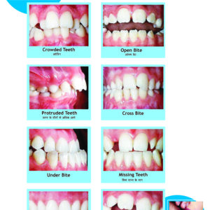 Hindi Dental Poster Smart Doc Posters