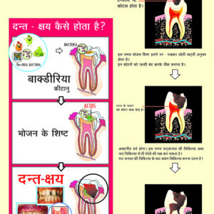 Hindi Dental Poster Smart Doc Posters