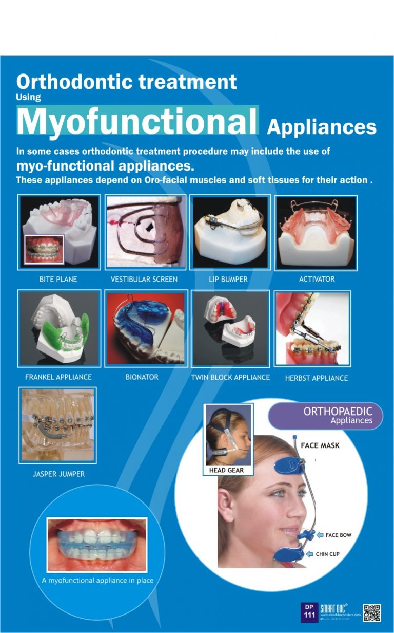Myo functional appliances in orthodontic treatment. (Eng.) DP111