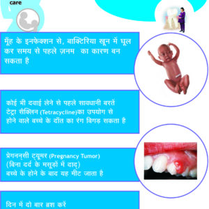Hindi Dental Poster Smart Doc Posters