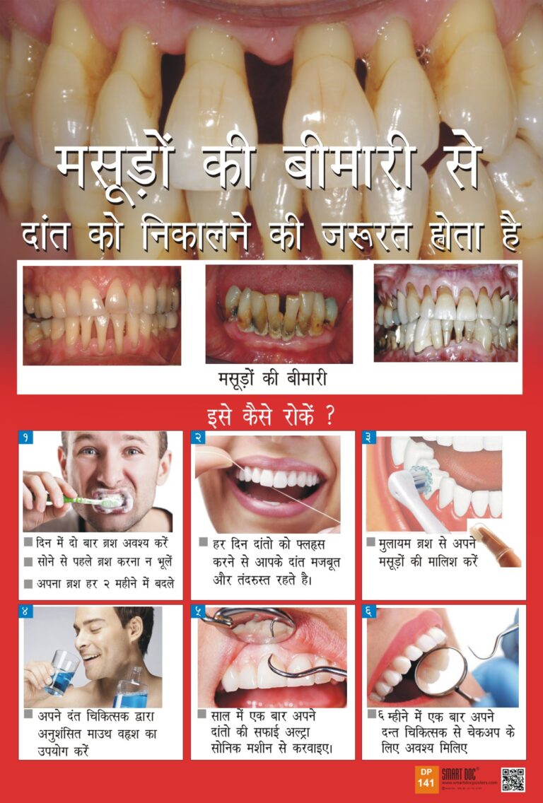 dp-141-hindi-severe-gum-disease-leads-to-tooth-loss-how-to-prevent