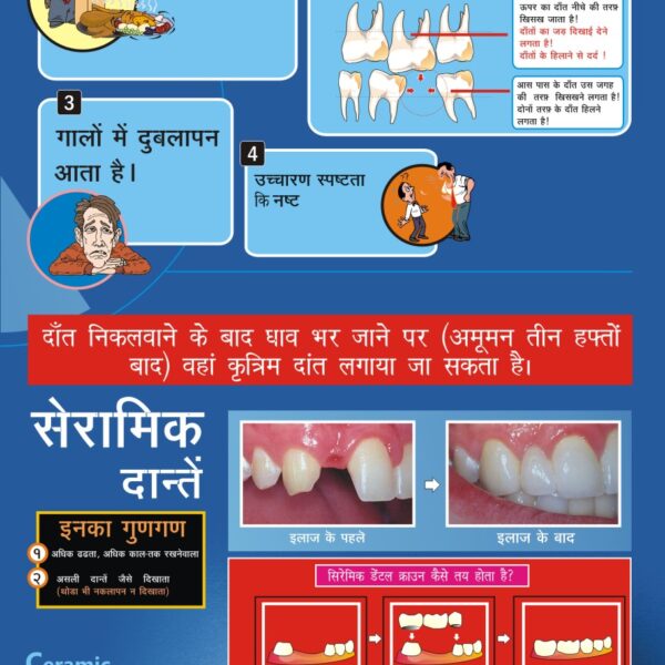 LONG SIZE DENTAL POSTERS in Hindi Smart Doc Posters