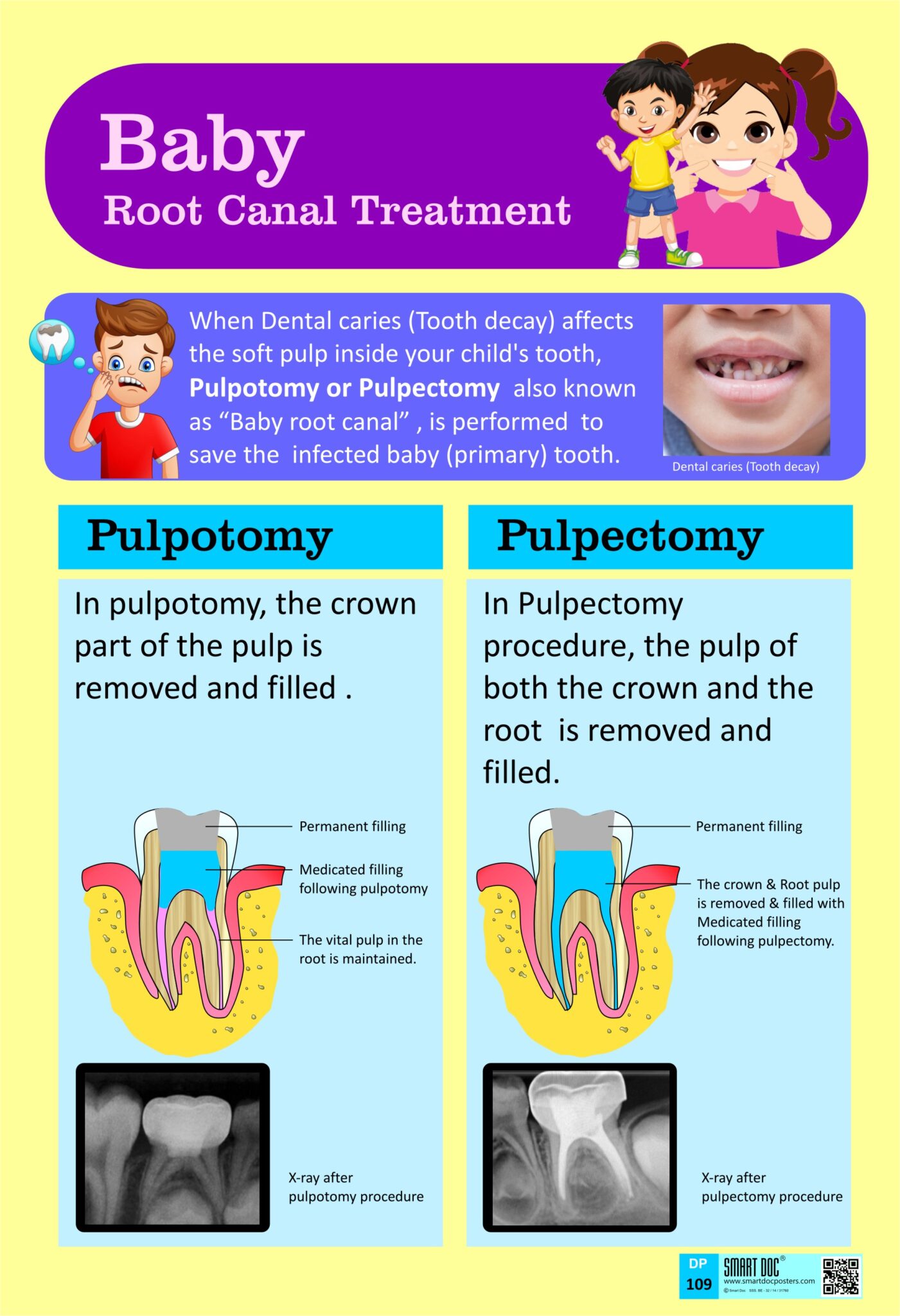 DP109 ( Eng.) . THE NEED FOR ROOT CANAL TREATMENT IN CHILDREN Smart